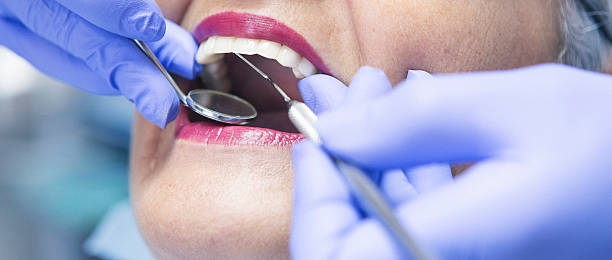Best Broken or Chipped Tooth Repair in Harris Hill, NY